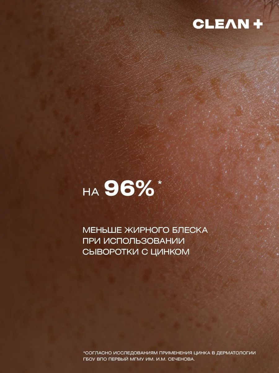 Сыворотка для лица от прыщей ниацинамид ACNE CONTROL, 30 мл