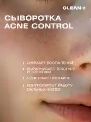 Сыворотка для лица от прыщей ниацинамид ACNE CONTROL, 30 мл