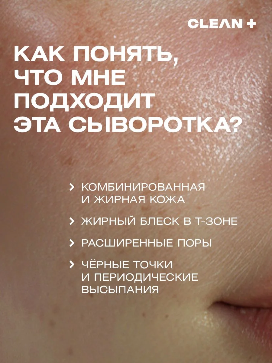 Сыворотка для лица от прыщей с кислотами VITA POWER, 30 мл