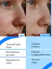 Гель для умывания увлажняющий, для сухой чувствительной кожи