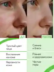 Гель для умывания лица от прыщей для жирной кожи с кислотами