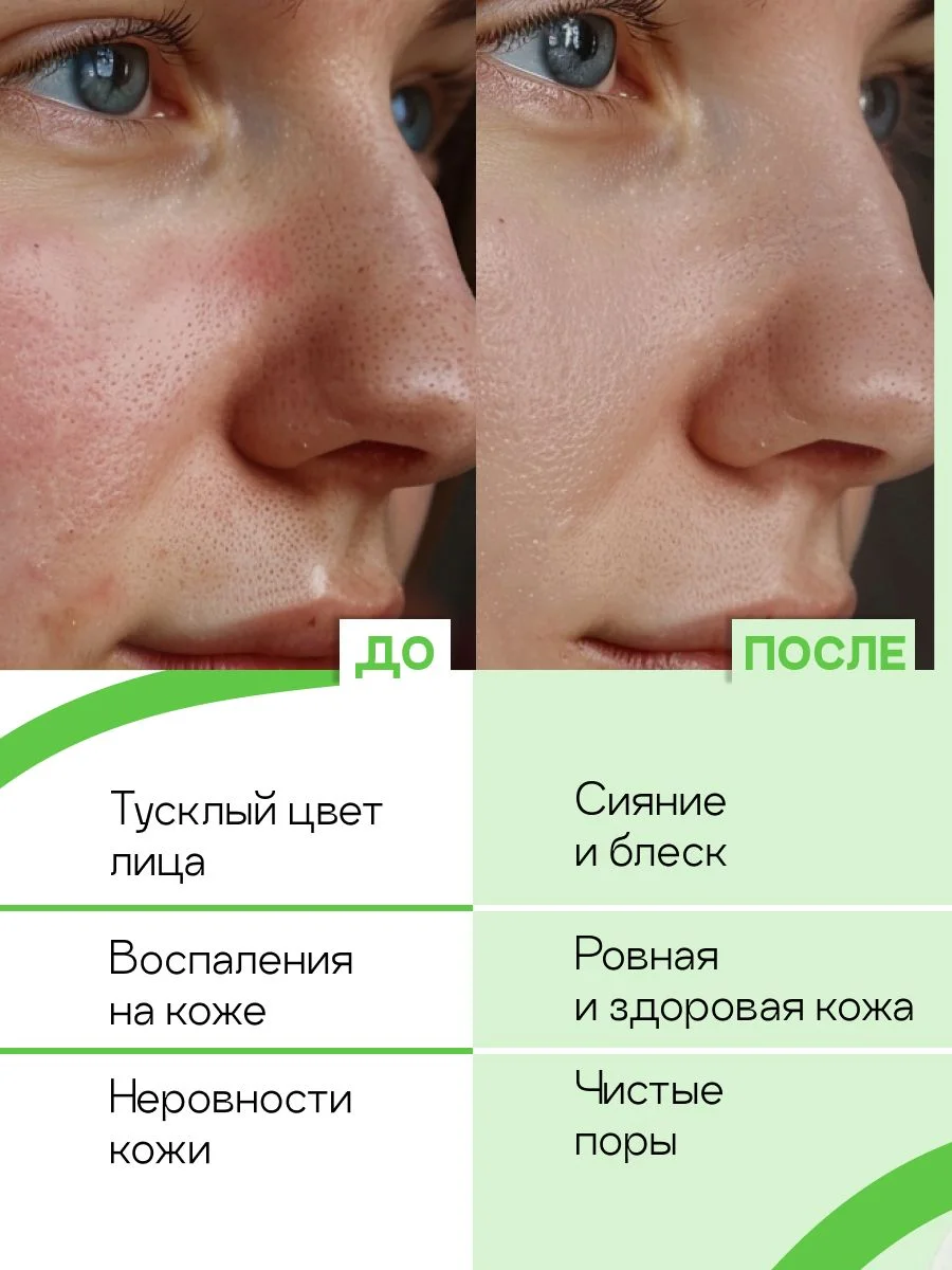 Гель для умывания лица очищающий от прыщей, для жирной кожи