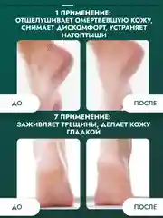 Кератолитик SEMILY от мозолей и натоптышей, 400 мл