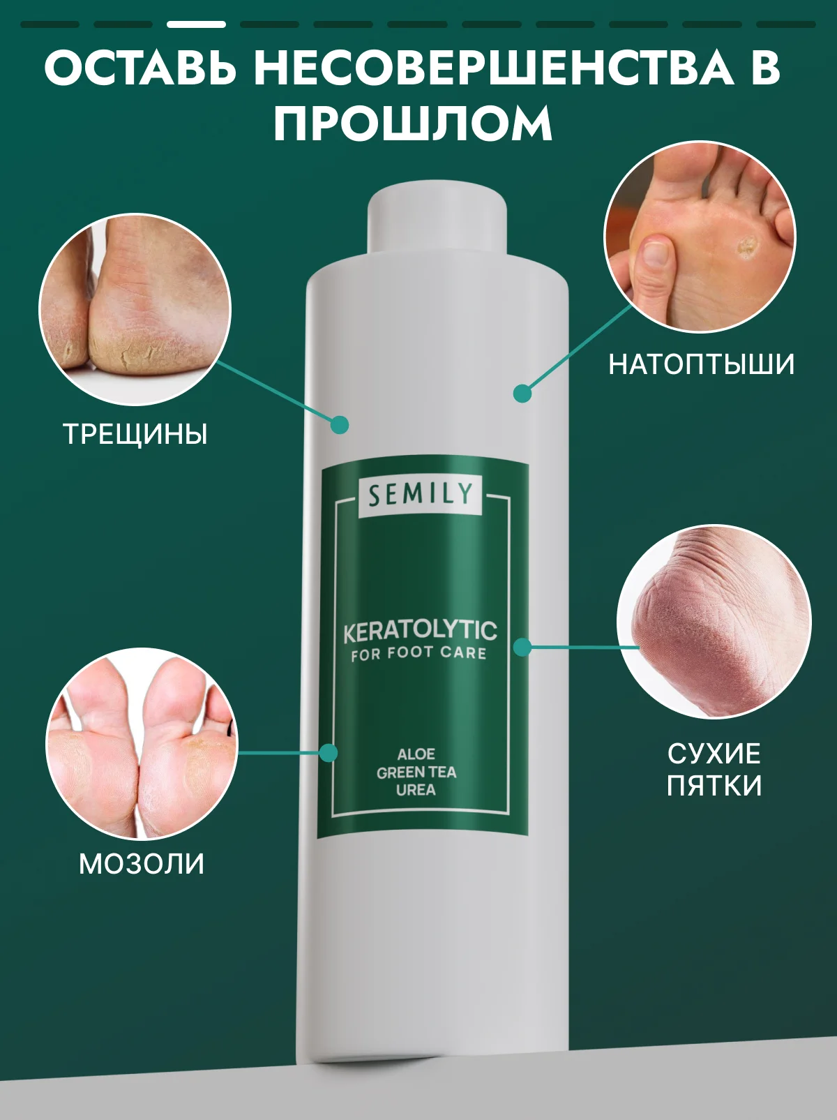 Кератолитик SEMILY от мозолей и натоптышей, 400 мл