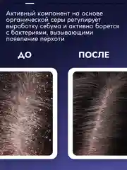 Пилинг SEMILY для кожи головы, 150 мл