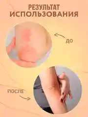 Экстракт "Молочай" мазь от псориаза, снимает воспаление, уничтожает грибок / 100 гр, воск