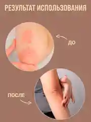Маска от прыщей "Зеленый грецкий орех" лечебное средство для тела, крем для ног/ 50 г
