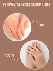 Маска от прыщей "Зеленый грецкий орех" лечебное средство для тела, крем для ног/ 50 г