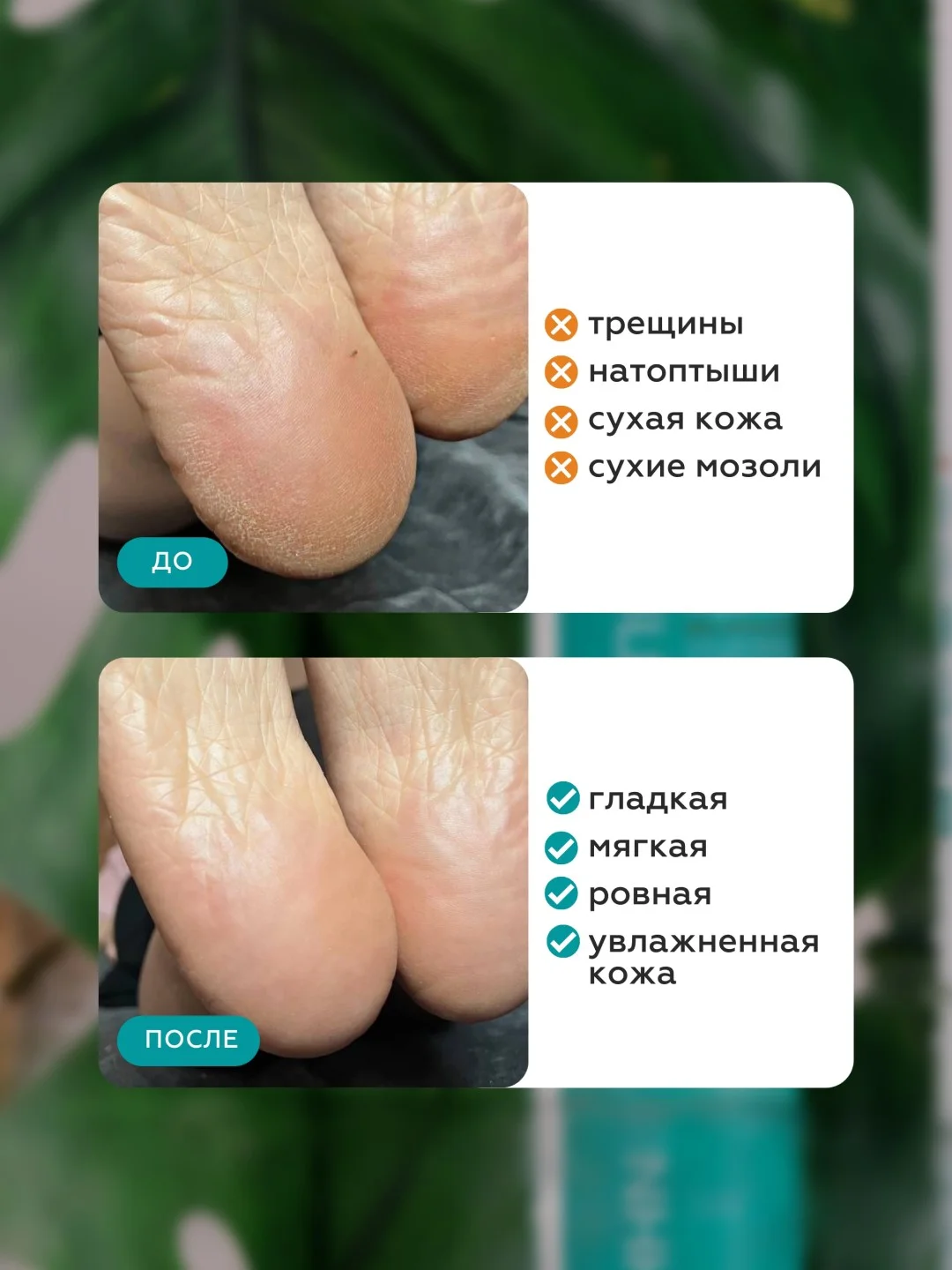 Гель для пяток от натоптышей и огрубевшей кожи, средство для педикюра жидкое лезвие +пемза