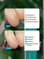 Гель для пяток от натоптышей и огрубевшей кожи, средство для педикюра жидкое лезвие +пемза