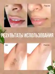 Эпилятор для женщин. Масляный депилятор с экстрактом дурмана. Крем для депиляции / 12 г