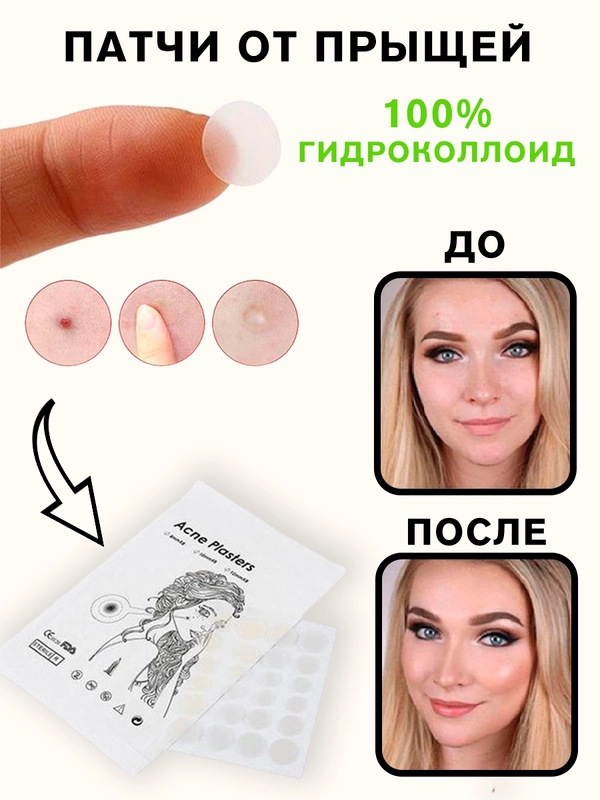Наклейки-патчи от прыщей 36 штук (1 лист), гидроколлоидные пластыри для ...