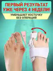 Вальгусный корректор для большого пальца, вальгусная шина для выпрямления косточки на ноге