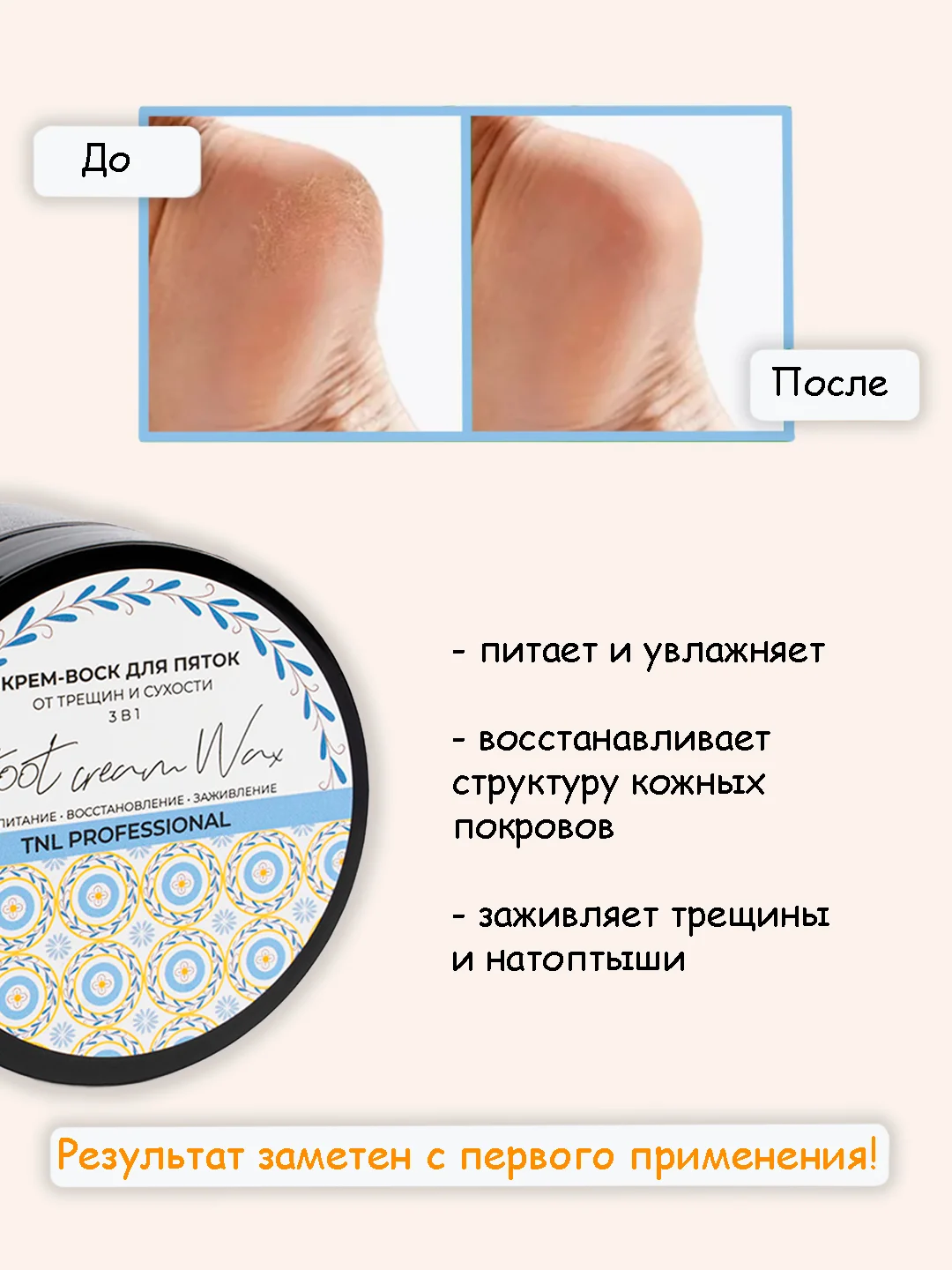 Крем-воск от трещин, для сухой кожи пяток ног, TNL, увлажняющий