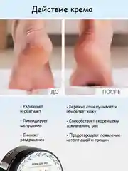 Крем для ног, с мочевиной, увлажняющий, от трещин, TNL
