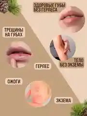 Экстракт "Живица кедра"мазь от псориаза, от боли в суставах, отеков и усталость ног/100 г