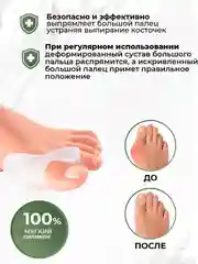Вальгусный гелевый силиконовый фиксатор, корректор для большого пальца ноги