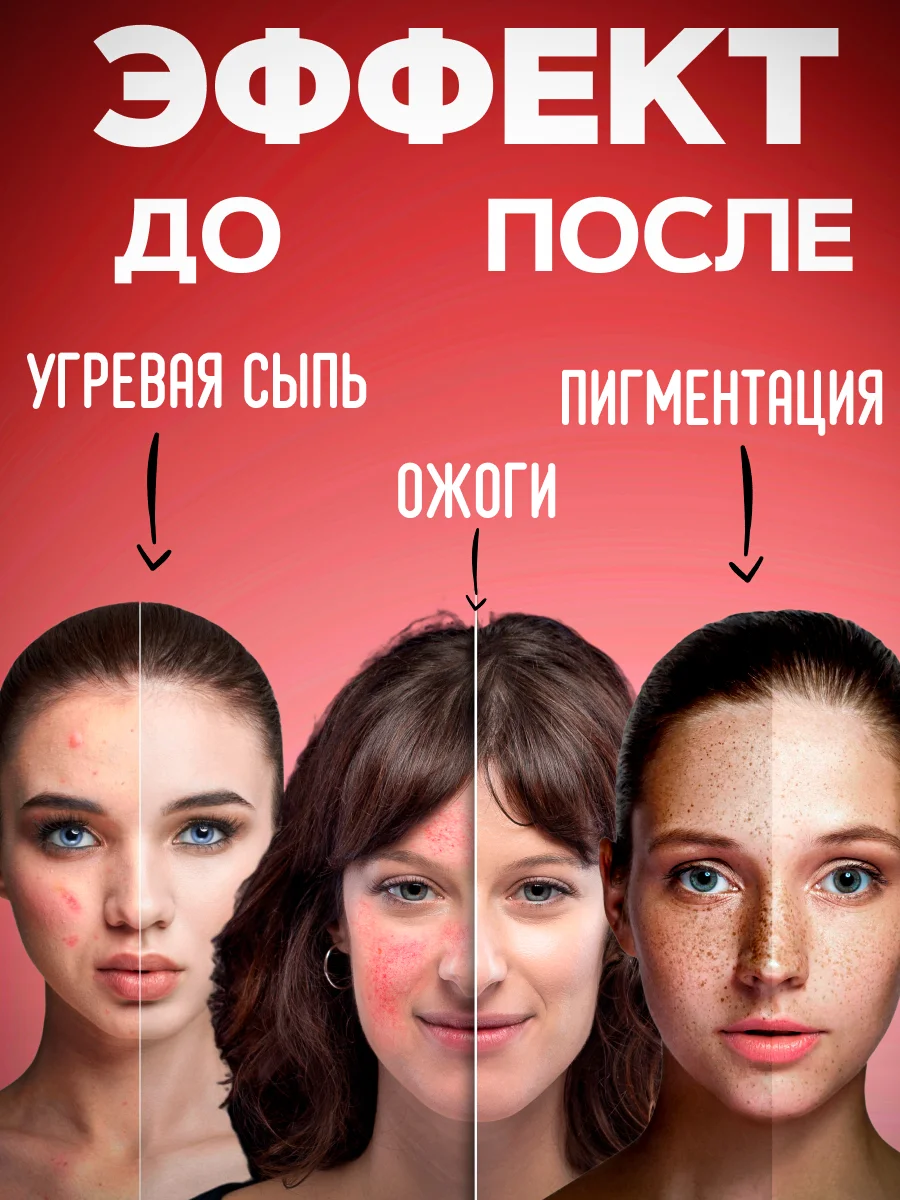 Экстракт ЗВЕРОБОЙ сыворотка от морщин,от прыщей,масло от пигментных пятен, от ожогов/12 г