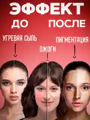 Экстракт ЗВЕРОБОЙ сыворотка от морщин,от прыщей,масло от пигментных пятен, от ожогов/12 г