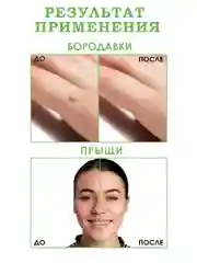 100% Экстракт Чистотел от папиллом,прыщей,угрей,бородавок,псориаз,сыворотка от прыщей/12гр