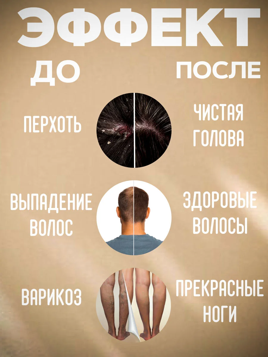 Экстракт "СОФОРА" масло для волос, от перхоти, от псориаза,регенирирующее,заживляющее/100г