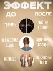 Экстракт "СОФОРА" масло для волос, от перхоти, от псориаза,регенирирующее,заживляющее/100г