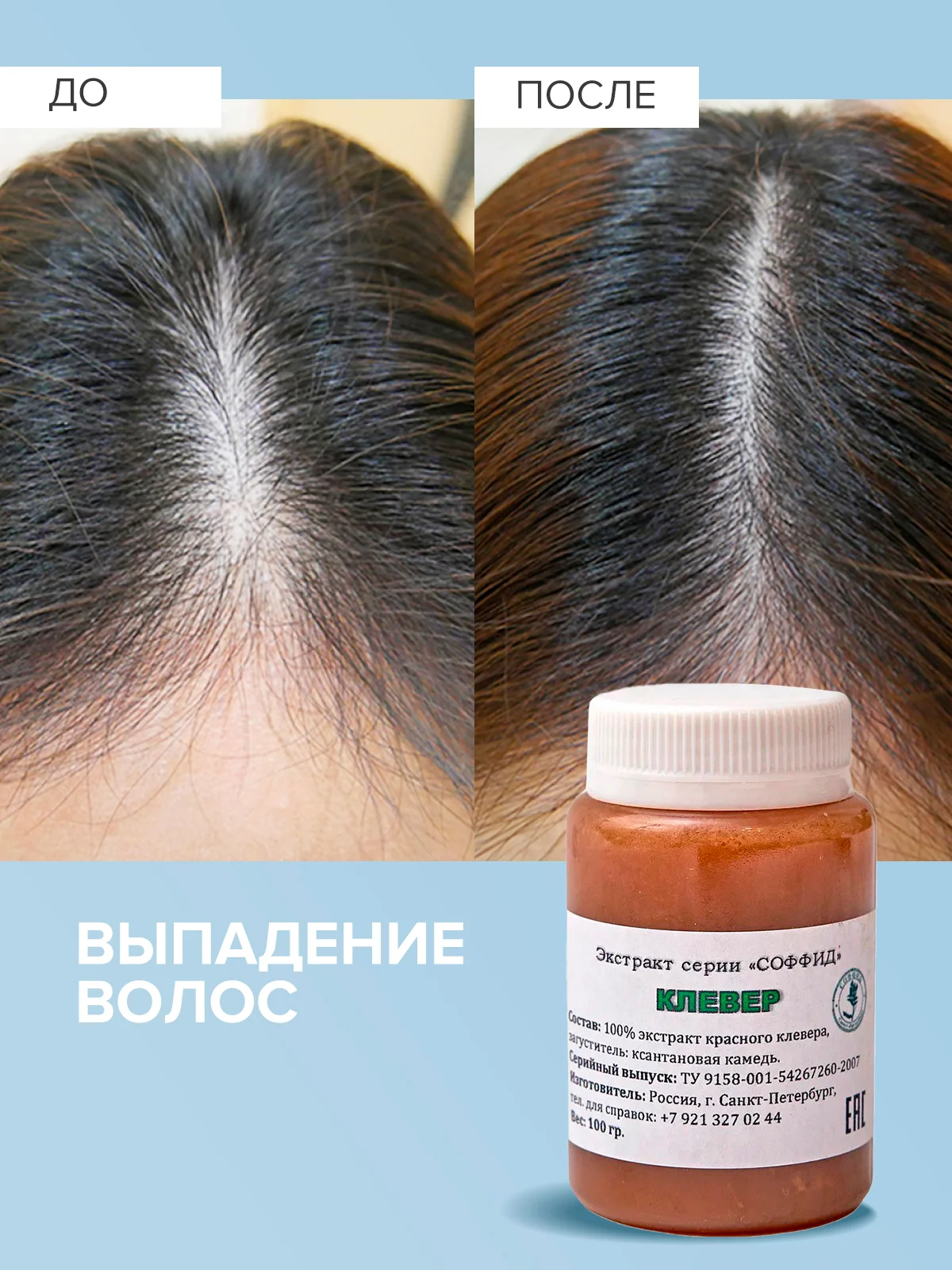 Крем для лица и тела с витаминами, от прыщей, от псориаза и дерматита/ Красный клевер, 100 г