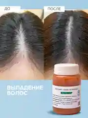 Крем для лица и тела с витаминами, от прыщей, от псориаза и дерматита/ Красный клевер, 100 г