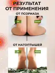 Эктракт мазь Чёрный орех эффективная мазь от геморроя, пролежней 100 гр кс