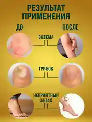 Мазь от псориаза, от запаха ног, от грибка ногтей на ногах, мох сфагнум / 108 трав, 100 г