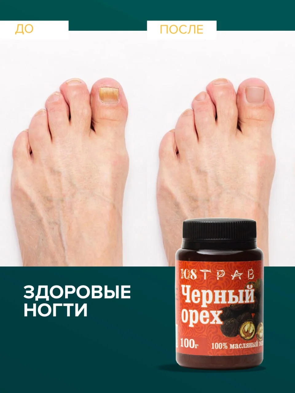 Крем-эмульсия черного ореха от псориаза, дерматита, экземы, мазь от геморроя, 108 трав, 100 г