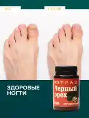 Крем-эмульсия черного ореха от псориаза, дерматита, экземы, мазь от геморроя, 108 трав, 100 г