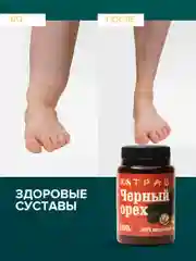 Крем-эмульсия черного ореха от псориаза, дерматита, экземы, мазь от геморроя, 108 трав, 100 г