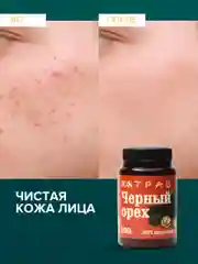 Крем-эмульсия черного ореха от псориаза, дерматита, экземы, мазь от геморроя, 108 трав, 100 г