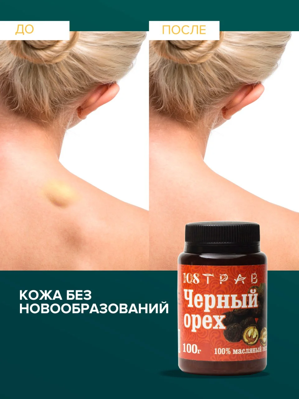 Крем-эмульсия черного ореха от псориаза, дерматита, экземы, мазь от геморроя, 108 трав, 100 г