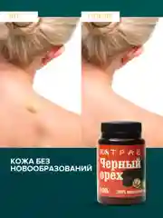 Крем-эмульсия черного ореха от псориаза, дерматита, экземы, мазь от геморроя, 108 трав, 100 г