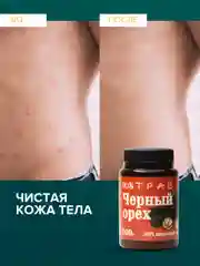 Крем-эмульсия черного ореха от псориаза, дерматита, экземы, мазь от геморроя, 108 трав, 100 г