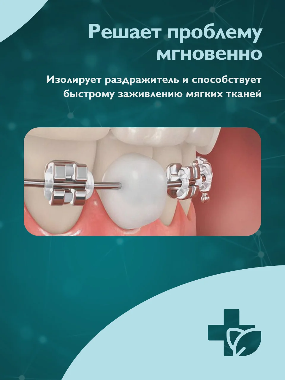 Воск для брекетов Dent & Dont, мягкий