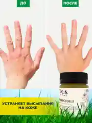 Крем Чистотел для сухой кожи, от трещин, лечение грибка ногтей, от натоптышей, 108 трав