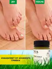 Крем Чистотел для сухой кожи, от трещин, лечение грибка ногтей, от натоптышей, 108 трав