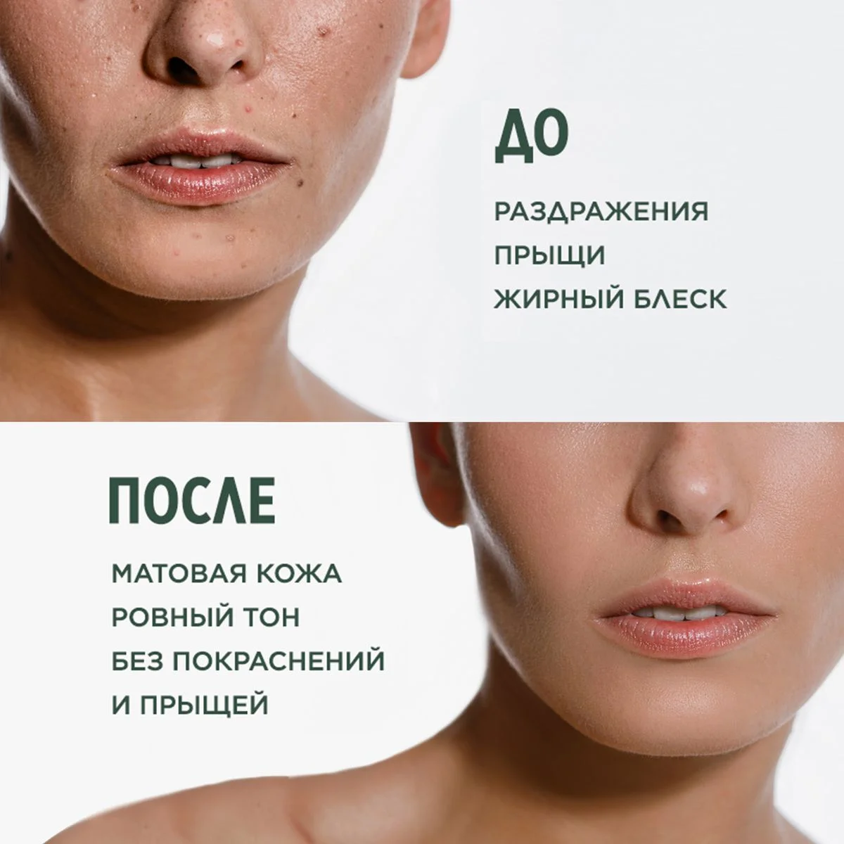 Meditaura Крем флюид для лица увлажняющий от прыщей для жирной кожи матирующий 50 мл
