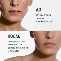 Meditaura Крем флюид для лица увлажняющий от прыщей для жирной кожи матирующий 50 мл