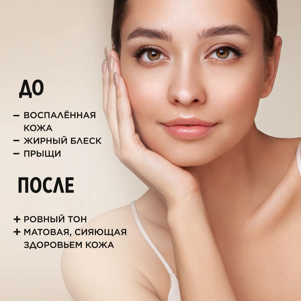 Meditaura Крем для лица от прыщей увлажняющий для жирной и проблемной кожи 50 мл