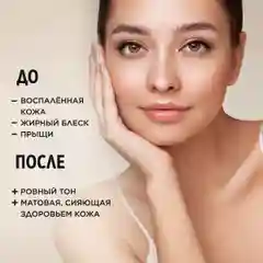 Meditaura Крем для лица от прыщей увлажняющий для жирной и проблемной кожи 50 мл