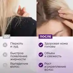 HAIROSA Пилинг для кожи головы профессиональный от перхоти кислотный Scalp AHA-Peel 150 мл