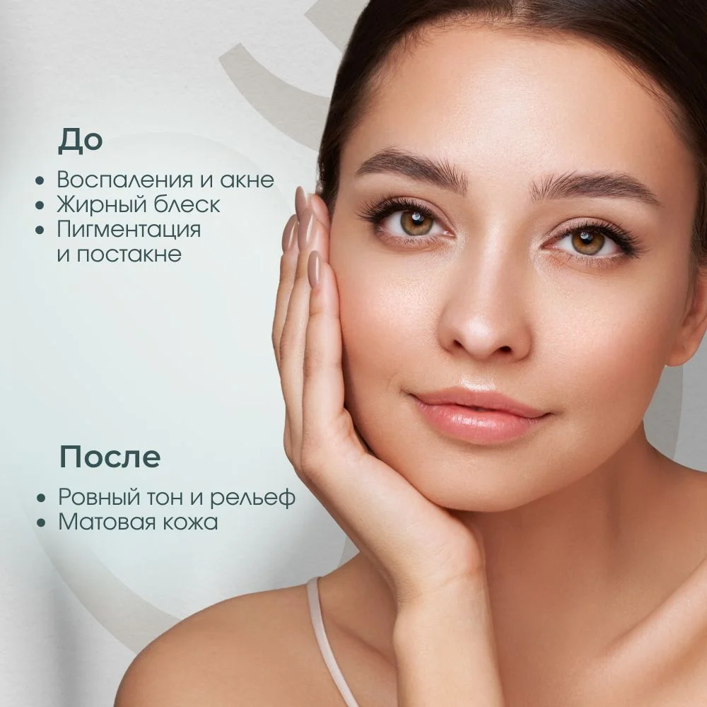 Meditaura Сыворотка для лица увлажняющая от прыщей с ниацинамидом Skin Harmony, 30 мл