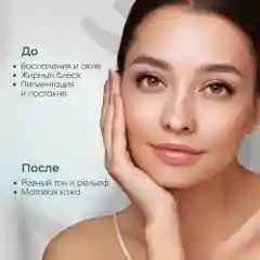 Meditaura Сыворотка для лица увлажняющая от прыщей с ниацинамидом Skin Harmony, 30 мл