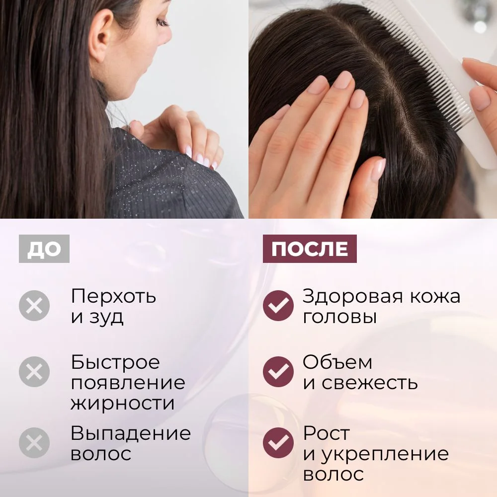HAIROSA Пилинг для кожи головы профессиональный от перхоти с фруктовыми кислотами, 150 мл