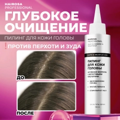 HAIROSA Пилинг для кожи головы профессиональный от перхоти с фруктовыми кислотами, 150 мл
