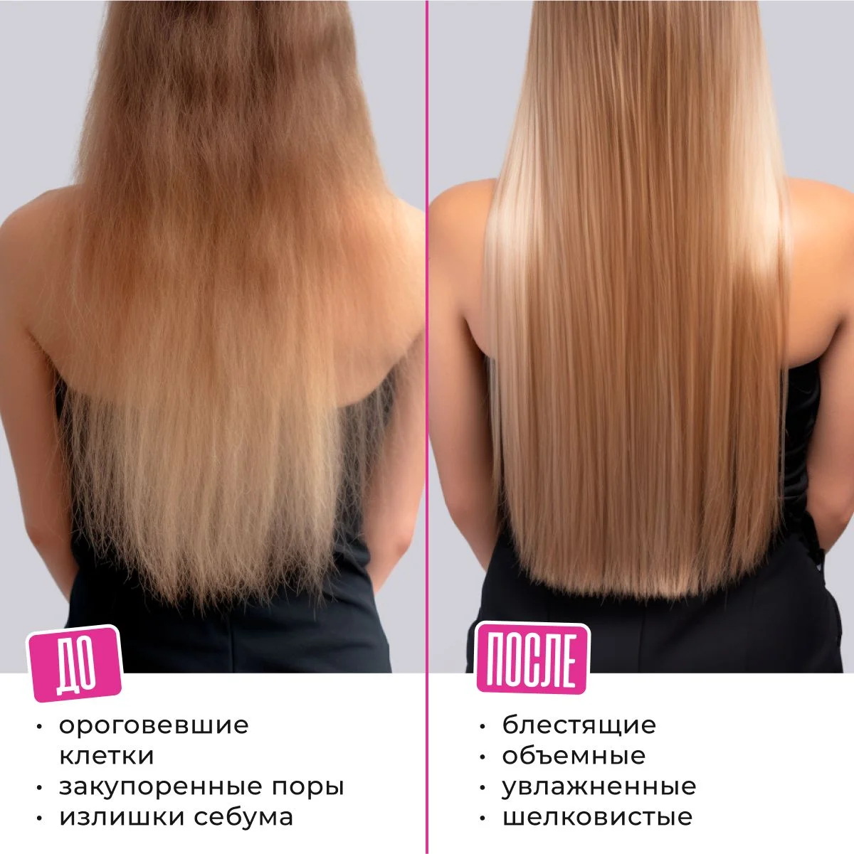 HAIRICA Пилинг для кожи головы профессиональный от перхоти кислотный Peel Power, 150 мл